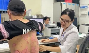 Khoảng hai triệu người Việt mắc bệnh vảy nến Khoảng hai triệu người Việt mắc bệnh vảy nến